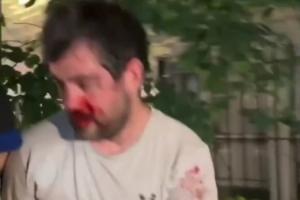 邓肯被打退出刺籍！纽约暴徒围殴“邓肯”！血流满面脱球衣逃生